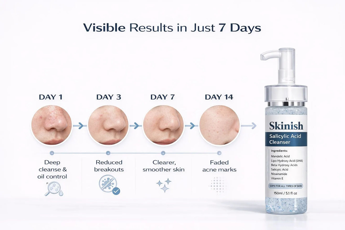 Skininish Salicylic Acid Cleanser with before-and-after effects on skin over 14 days.